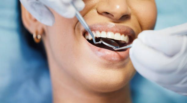 Best Emergency Tooth Extraction in Mannford, OK